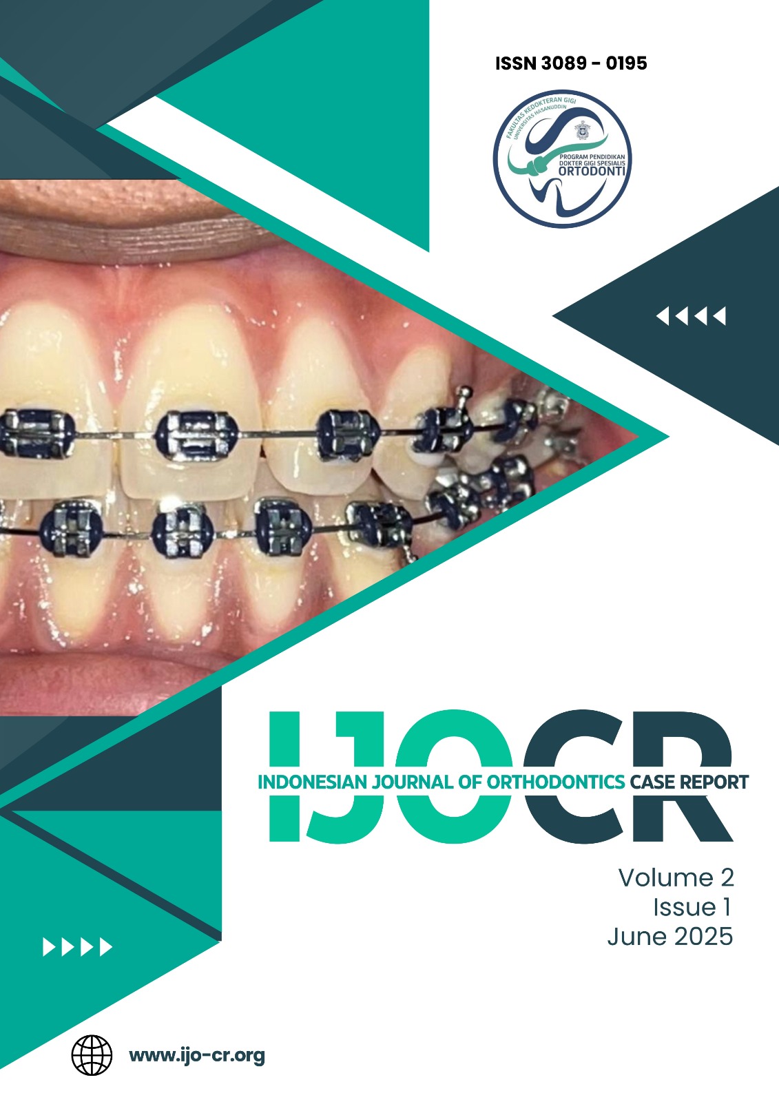 					View Vol. 2 No. 1 (2025): Vol 2, Issue 1, Juni 2025
				